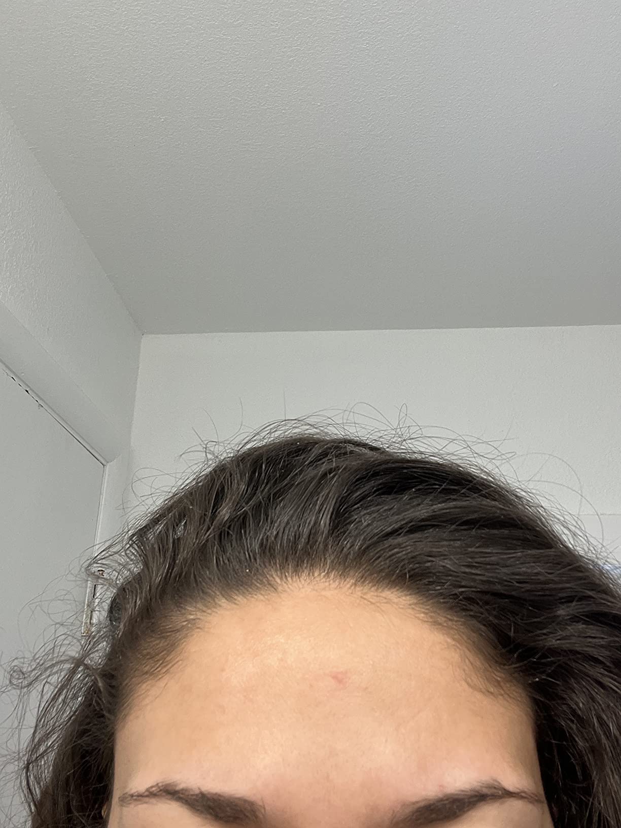 Customer photo of the same forehead with the red spot much less visible